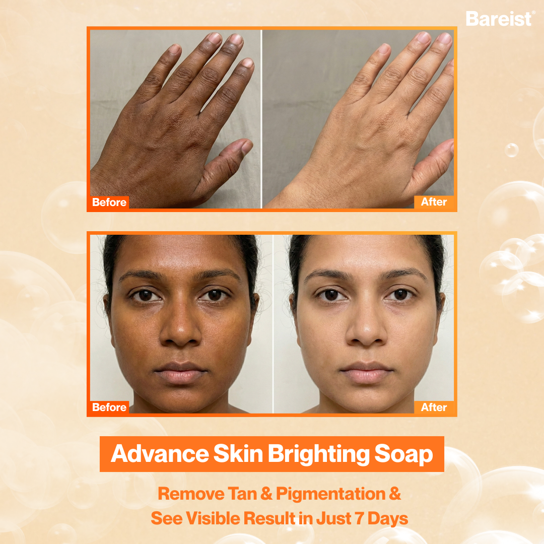 Bareist® Skin Brightening Bar | 2% Kojic Acid, 1% Glutathione, 1% Niacinamide | Reduce Dark Spots, Tan & Pigmentation | For Men & Women