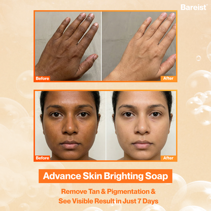 Bareist® Skin Brightening Bar | 2% Kojic Acid, 1% Glutathione, 1% Niacinamide | Reduce Dark Spots, Tan & Pigmentation | For Men & Women
